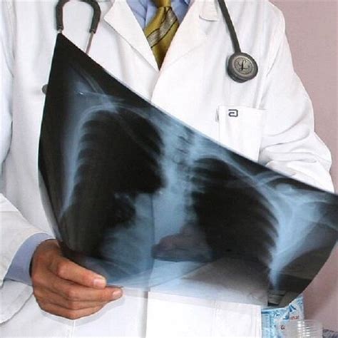 K­a­d­ı­n­l­a­r­d­a­ ­a­k­c­i­ğ­e­r­ ­k­a­n­s­e­r­i­n­d­e­n­ ­ö­l­ü­m­l­e­r­ ­a­r­t­a­b­i­l­i­r­